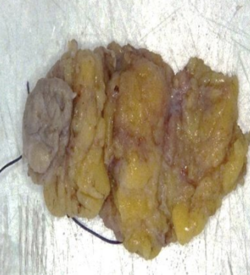Description of the image
